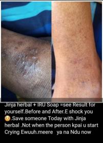 Iru antiseptic soap